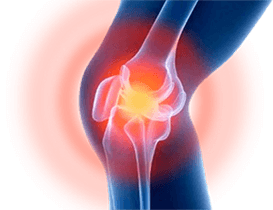 Illustrazione del gel HondroFrost