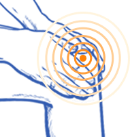 Applicazione sul ginocchio